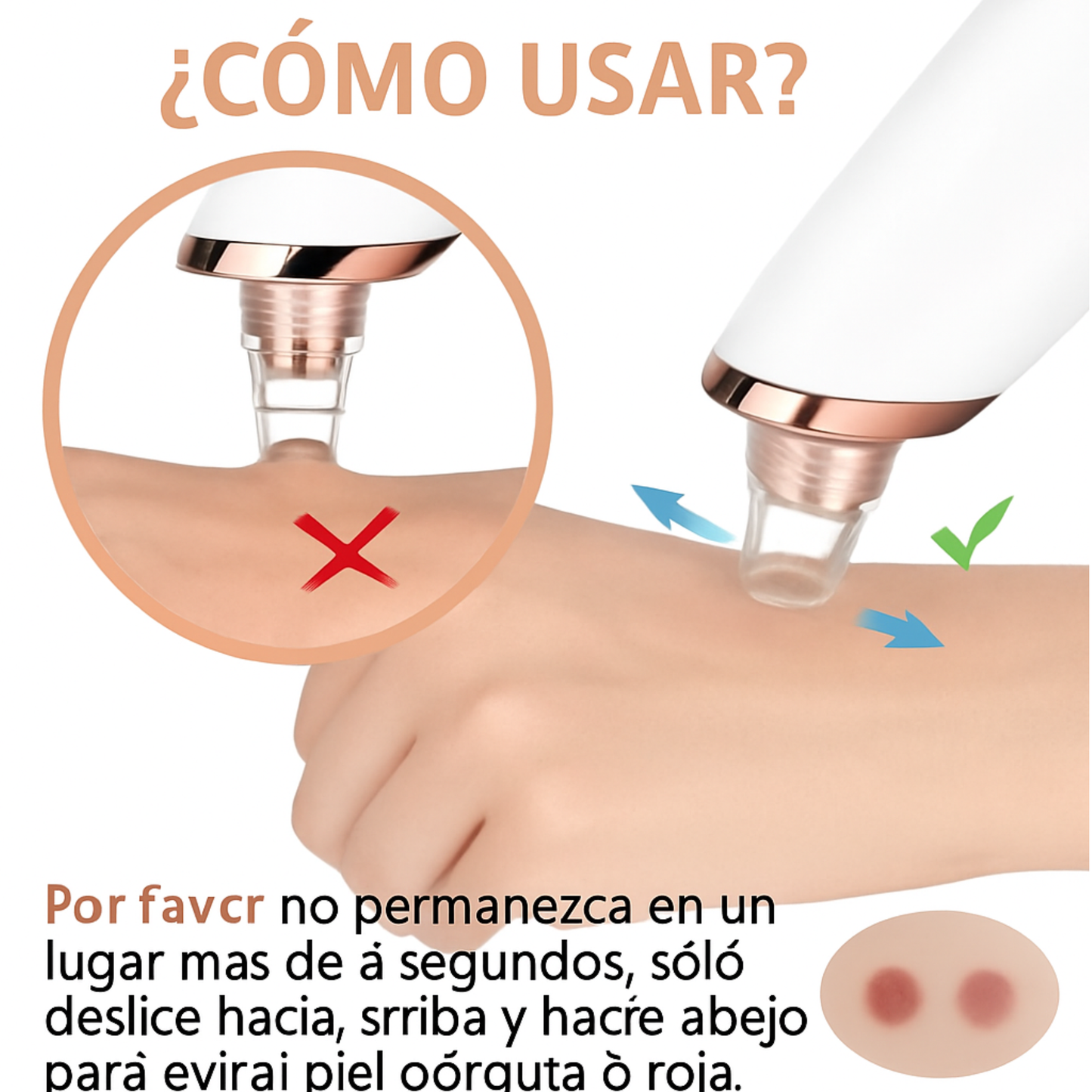 Removedor  de espinillas y limpia poros