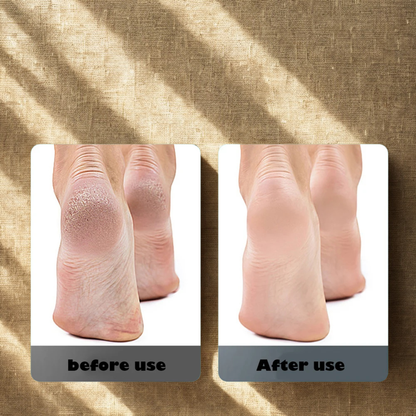 LIMA PARA PIES ELECTRICA