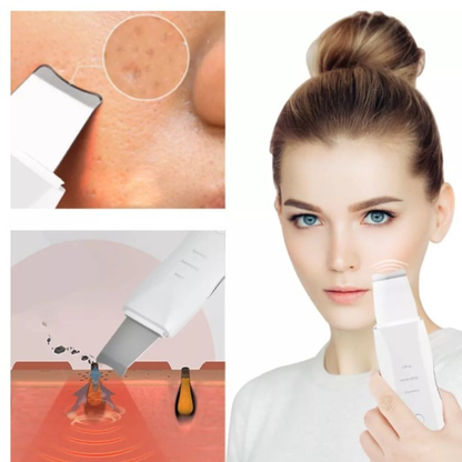 ESPATULA PARA PUNTOS NEGROS